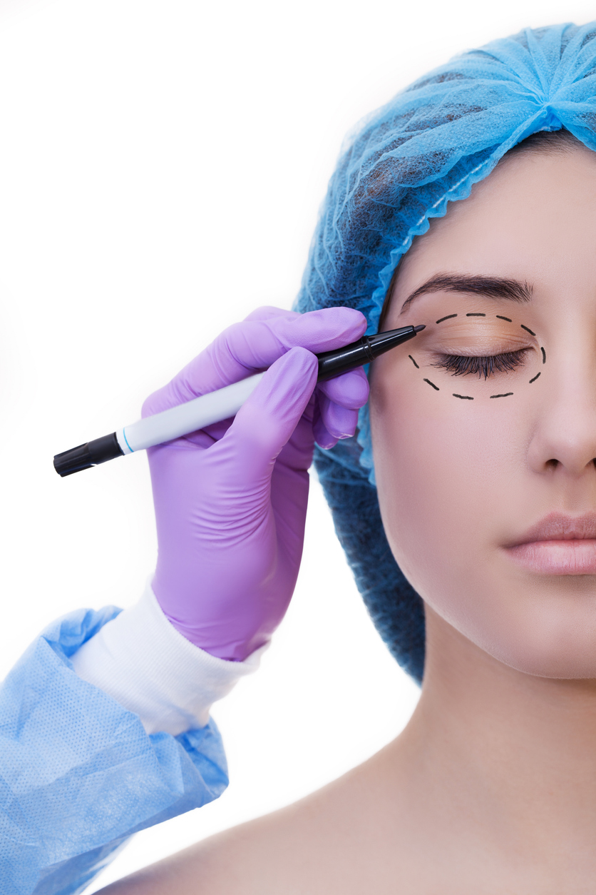 The image shows a woman preparing for eyelid surgery and shows what to expect from revision eyelid surgery.