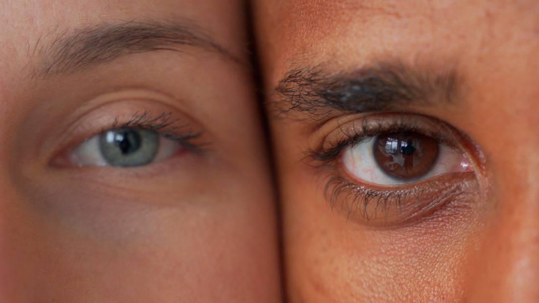 Featured image for Are there differences between male and female blepharoplasty